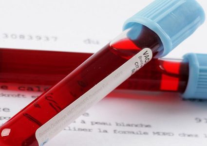 مرض قاتل مرتبط بطعام ملوث يهدد 16 دولة