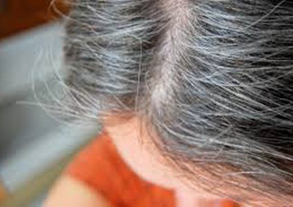 طريقة لاتصدق للتخلص من الشيب بالرأس!