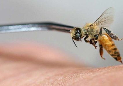 وفاة سيدة بعد علاجها باستخدام النحل!