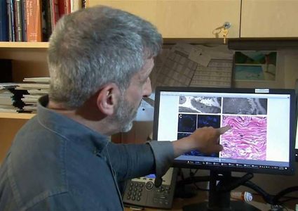 اكتشاف عضو جديد في جسم الانسان!