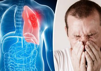 ما هي أعراض سرطان الرئة ؟