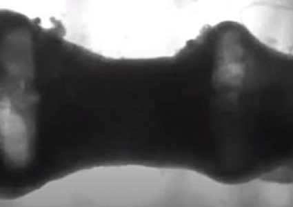 علماء يقومون بإنماء قلب من الخلايا الجذعية