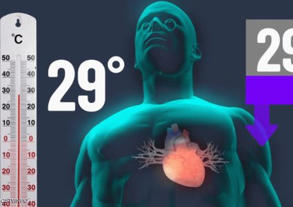 فرنسي توقف قلبه لـ16 ساعة وعاد للحياة