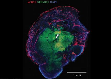 إنماء أدمغة بشرية مصغرة للمرة الأولى