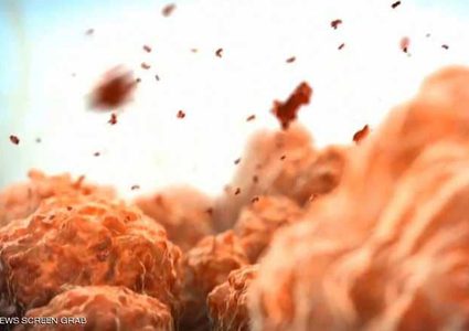 علاج جديد قبل إزالة الأورام يوقف السرطان