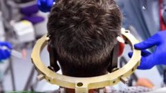 أحدث الطرق لعلاج مرض الزهايمر (فيديو)