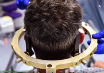 أحدث الطرق لعلاج مرض الزهايمر (فيديو)