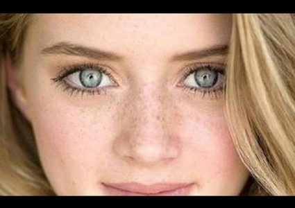 ماذا يستطيع "نمش العين" أن يخبرك عن صحتك ؟