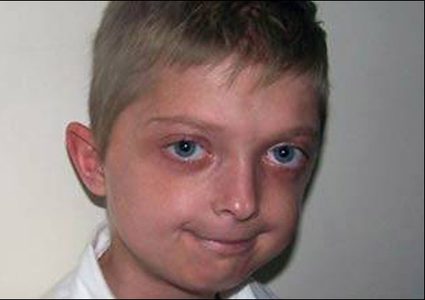 دراسة تمنح الأمل لأطفال "الشيخوخة المبكرة"