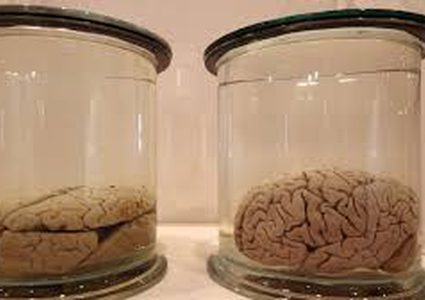 نجاح تجربة حفظ أدمغة بعد الموت!