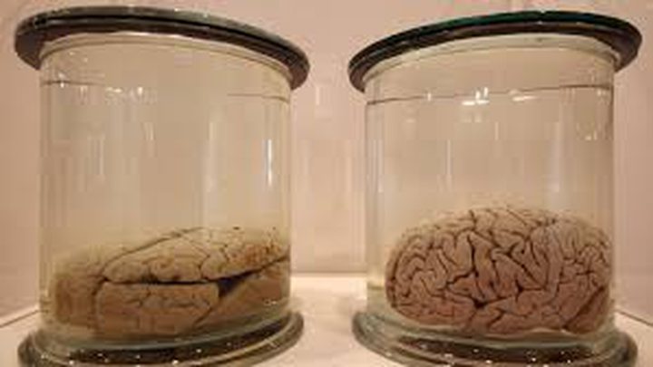 نجاح تجربة حفظ أدمغة بعد الموت!