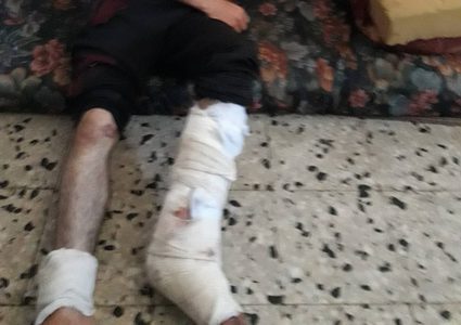 شاب أصيب ثماني مرات ولازال يشارك في مسيرات العودة