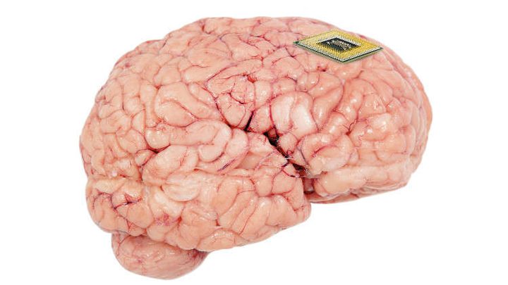 علماء يبتكرون أصغر محفز عصبي في العالم