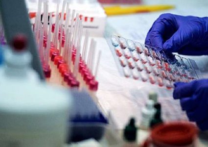 علماء يكتشفون "أخطر" فئات الدم!