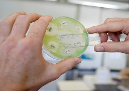 شركة تسحب منتجات حمص وباذنجان مُصنع من السوق.. والسبب!