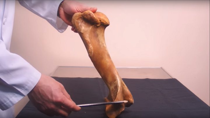 علماء روسيا يطورون "عظما اصطناعيا" جديدا