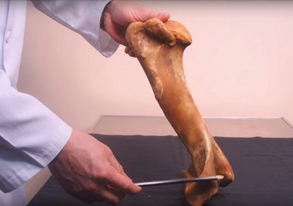 علماء روسيا يطورون "عظما اصطناعيا" جديدا