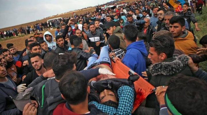 سلطات الاحتلال ترفض السماح لجرحى غزة بتلقي العلاج في تركيا