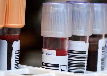 القاء القبض على باحثة استخدمت دمها في أبحاث سرطان