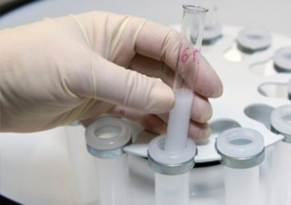 هل الوخز بالإبر يزيد فرص الإنجاب بعد التلقيح!