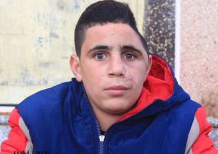 قوات الاحتلال تختطف الطفل الجريح "محمد التميمي" من النبي صالح