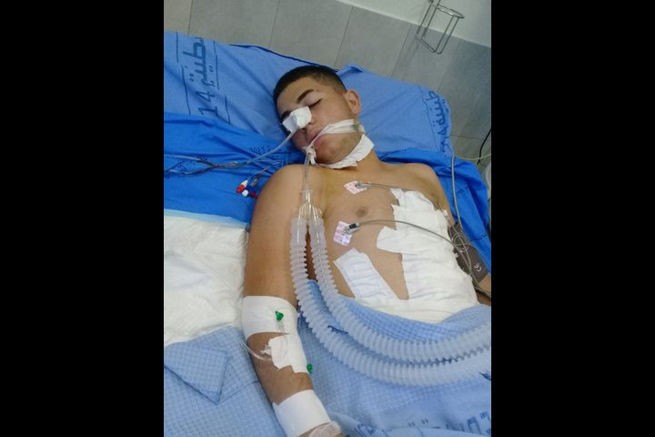 استشهاد طفل متأثرا بجروحه شمال رام الله