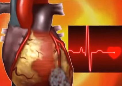 لأول مرة.. العلماء يتحكمون بالقلب باستخدام الليزر!