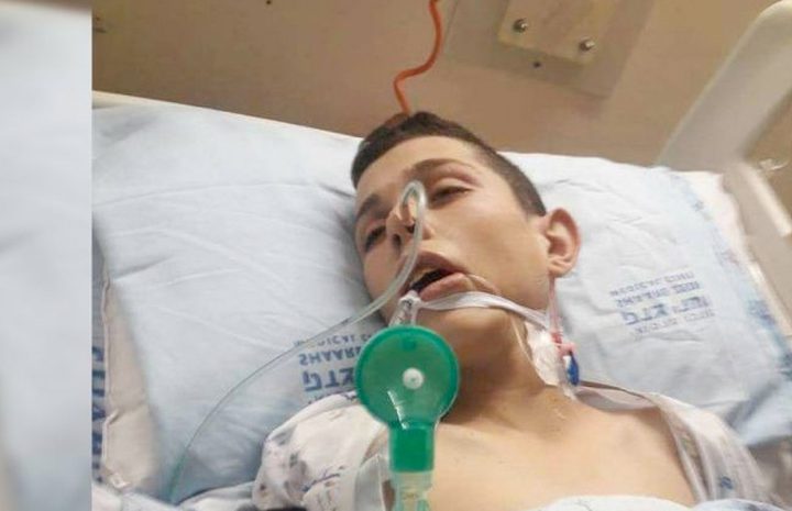 الفتى حسان التميمي يفقد بصره كلياً بسبب الاهمال الطبي