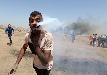 الكشف عن هوية "مصاب قنبلة الغاز في وجهه" وحالته الصحية