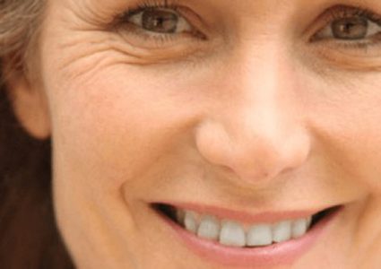 لماذا ينصح الخبراء بعدم إزالة تجاعيد الوجه؟