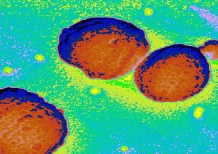 علماء يحذرون من بكتيريا ثلاثية الأخطار!