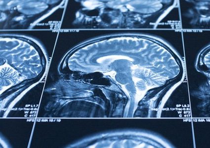 علماء يكتشفون طريقة انتقال المياه من الدم إلى الدماغ