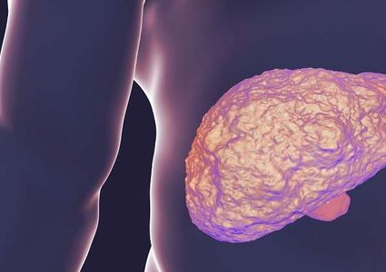 أطباء ينقذون فتاة عاشت حياتها بـ "أعضاء" خارج جسدها!