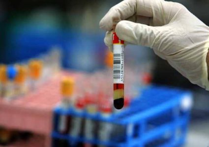 أول إصابة بشرية بفيروس ينتقل بين الحيوانات فقط