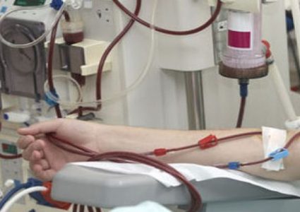 كيف يهدد الفوسفات حياة مرضى الكلى؟