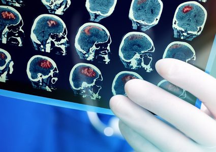 الفرق بين أدمغة الرجال والنساء سببه التنشئة وليس طبيعة الدماغ!