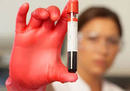 تطور جديد في مجال علاج مرض تعفن الدم