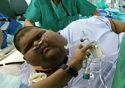 أسمن طفل في العالم يتمكن من إنقاص وزنه