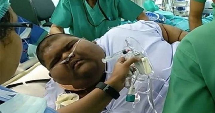 أسمن طفل في العالم يتمكن من إنقاص وزنه