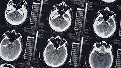 "BioMind" يتفوق على أمهر الأطباء في دقة تشخيص الأمراض
