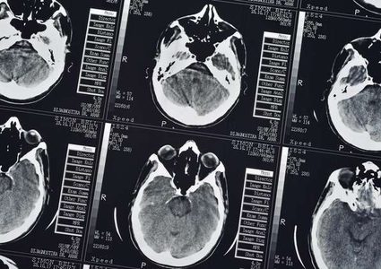 "BioMind" يتفوق على أمهر الأطباء في دقة تشخيص الأمراض