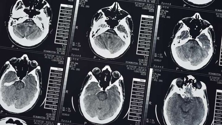 "BioMind" يتفوق على أمهر الأطباء في دقة تشخيص الأمراض