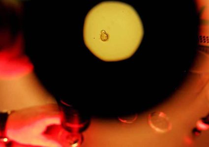 العلم يحذر من الجانب المظلم لتقنيات الإنجاب الحديثة