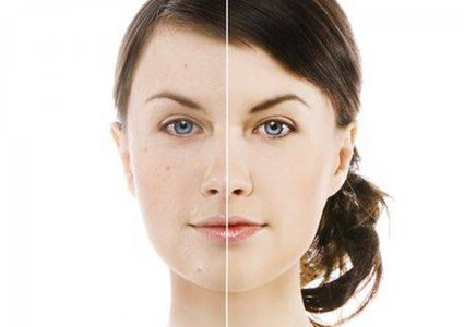 سرّ الألوان في إخفاء العيوب والبقع