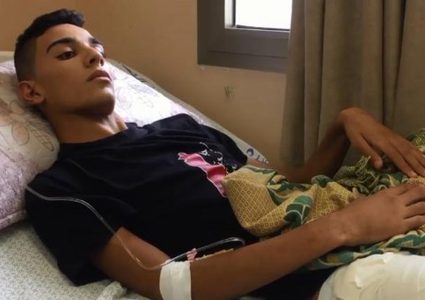 الاحتلال يتسبب ببتر قدم آدم سالم