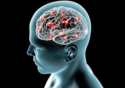 ما لا تعرفه عن "الصداع النصفي"