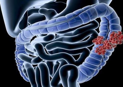 نصائح بسيطة تحميك من مرض قاتل!