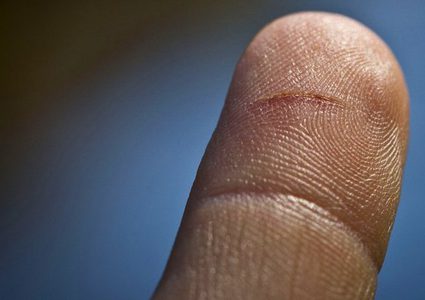 لماذا يؤذي خدش الورق أجسادنا؟