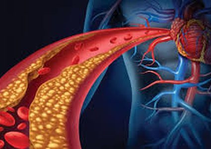 لماذا يحتاج مرضى انخفاض الكوليسترول إلى الستاتين؟