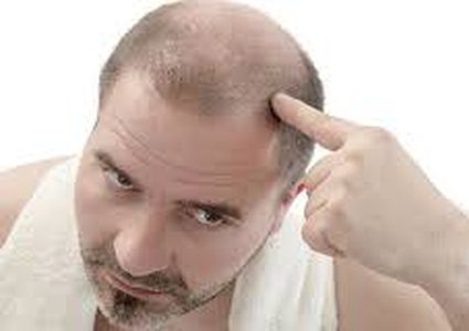 قريباً..."حبة دواء" تقضي على الصلع والشيب!